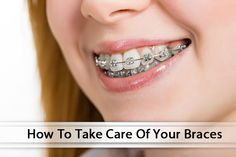 Taking good care of your #braces and keeping your mouth clean is your part of the job to achieve the smile you want. Like everything else you do for the first time, brushing and flossing with braces may take a little practice, but soon it will be second nature to you. #dentistry #orthodontics