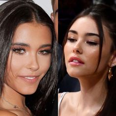 Madison Beer Plastic Surgery, Filler Face, Foxy Eye, Chin Filler, Lip Filler