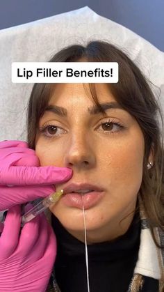 Cosmetic Fillers, Esthetician Inspiration, Face Fillers, Skin Aesthetics