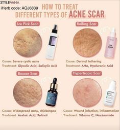 Serum For Acne, Different Types Of Acne, Forehead Acne, Skin Facts, Natural Acne Remedies, Acne Scar, Types Of Acne, Skin Care Tutorial