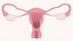 Menstruation Cycle, دورة شهرية, Polycystic Ovarian Syndrome, Fallopian Tubes, Polycystic Ovaries, Functional Medicine, Tampon, Omega 3, Acne