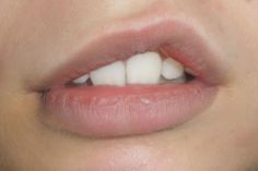 a close up view of a woman's mouth with white teeth