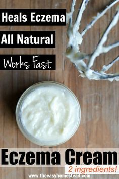 Homemade Eczema Cream | The Easy Homestead Anti Itch Cream, Homemade Lotion, Young Living Oils, Diet Vegetarian, Beauty Recipe, Essential Oil Recipes, Cream Recipes, Homemade Beauty Products