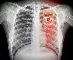 an x - ray shows the chest and ribs with a red light in it's center