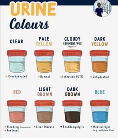 the different types of urine colors are shown in this poster, which shows how to use them