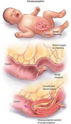 the stages of an infant's stomach and how it is attached to its mother