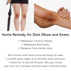 Tips to get of Dark Knees and Elbows #Skin #Beauty Dark Knees And Elbows, Dark Knees, Skin Care Routine For 20s, Clear Healthy Skin, Natural Skin Care Remedies, Natural Face Skin Care, Good Skin Tips, Beauty Tips For Glowing Skin, Perfect Skin Care Routine