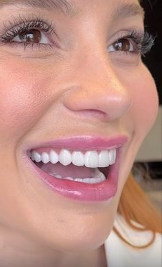 Perfect Teeth With Fangs, Manifestation Results, Short Teeth, Loose Teeth, Dental Mouthguards