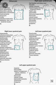 the diagram shows different types of muscles and how they are used to help you understand them