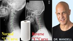 HOW A PAPER ROLL CAN RESTORE YOUR BAD NECK CURVE -  Dr Alan Mandell, DC - YouTube Better Posture, Senior Fitness, Organic Health