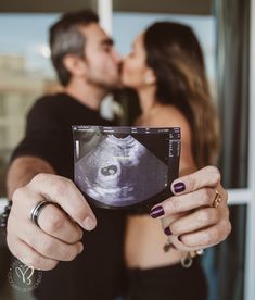 a man and woman kissing each other while holding an x - ray image in front of them