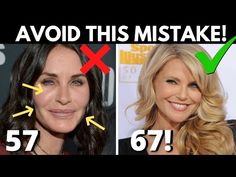 This method of getting facial filler will make you look older NOT younger (AVOID at all costs!) - YouTube