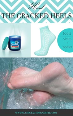 Quickest solution to cracked heels - Vicks Vaporub. #QuickTips #Remedy #HomeRemedies Heal Cracked Heels, Cracked Heel Remedies, Vicks Vapor Rub, Vicks Vapor, Uses For Vicks, Cracked Heels, Vicks Vaporub, Beauty Remedies, Homemade Beauty Products