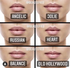 Types Of Lips Shape, Heart Shaped Lips, Lip Types, Facial Aesthetics, Botox Fillers