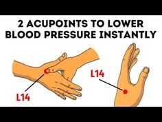 Pressure Point Therapy, Simple Graphic Design, Acupressure Therapy, Pressure Headache, Pressure Point