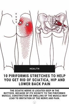 Piriformis Muscle, Piriformis Syndrome, Nerve Pain Relief