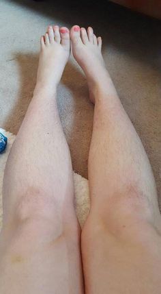 My hairy legs are my way of saying “I am independent. I am in charge. I can do what I want with my body.” Hair Positivity, I Am Independent, Disgusted Face, Improve Nutrition, How To Stop Snoring, Liver Detoxification, Body Hair Removal, Health Knowledge