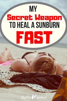 Heal Sunburn Fast, Treating Sunburn, Remedies For Sunburn, Home Remedies For Sunburn, Get Rid Of Sunburn, How To Treat Sunburn, Heal Sunburn, Sunburn Remedies, Pale White