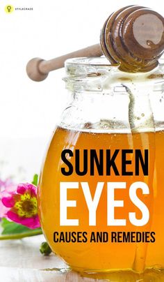 Sunken eyes are caused by exhaustion and aging. However, sometimes, they may indicate an underlying condition. Click here to learn how to improve sunken eyes. Sunken Eyes Remedy Natural, Sunken Eyes Remedy, Face Remedies, Dry Eyes Causes, Sunken Eyes, Massage Face, Swollen Eyes, Honey Benefits, Eye Infections