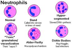 the different types of neutrophilia in humans and their respective body parts