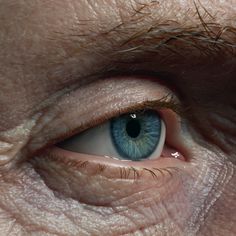 an older man's blue eye is seen through the iris of his left eye