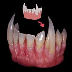 the teeth have been implanted with dental floss