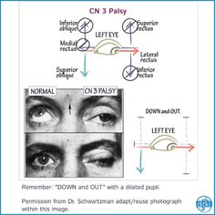 an eye diagram showing the different types of eyes and how they are used to see them