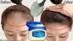 Diy Vaseline, Vaseline Hair, Vaseline Hair Tonic, Vaseline For Hair, Homemade Hair Treatments, Hair Growth Spray, Make Hair Grow, How To Grow Your Hair Faster