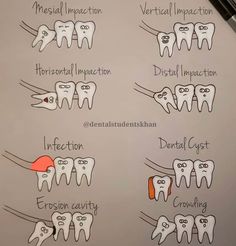 an image of dental hygiene chart with teeth