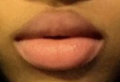 Round Cupids Bow Lips Aesthetic, Round Lips Aesthetic, No Cupids Bow Lips, Full Round Lips, Full Lips Aesthetic, Rounded Cupids Bow Lips, Plump Lips Aesthetic, Fluffy Lips, Desired Lips