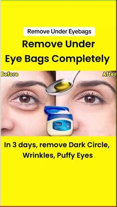 Say goodbye to tired eyes with our homemade miracle cream! Crafted with natural ingredients, this DIY remedy targets dark circles, bags, and wrinkles. #DIYBeauty #NaturalSkincare #RadiantYouth Remove Under Eye Bags, Eye Circle Remedies, Eye Wrinkles Remedies, Remove Eye Wrinkles, Puffy Eyes Remedy, Wrinkles Remedies Face, Natural Eye Cream, Remove Eye Bags, Natural Face Skin Care