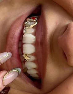 a close up of a person's mouth and teeth with gold rings on it