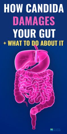 Treating candida naturally is important to improve overall gut health. #candida #candidaovergrowth #candidasupplements #candidatest #candidaremedies Parasites Symptoms, Candida Supplements, Fish Oil Benefits, Heal Leaky Gut, Candida Albicans, Digestive Tract, Gut Healing