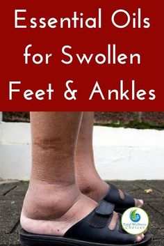 Best essential oils for swollen ankles and feet that can help reduce swelling in your feet or ankles! #essentialoils #naturalremedies #swollenfeet #swollenanklesremedy via @wellnesscarol Essential Oil For Swelling, Essential Oils For Inflammation, Swollen Ankles, Oils For Health, Essential Oils For Pain, Essential Oil Remedy, Essential Oils Health, Reduce Swelling, Living Essentials Oils