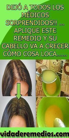 COMO ELIMINAR LAS CANAS NATURALMENTE CON REMEDIOS CASEROS Hair Medicine, Face Tips, Home Remedies For Hair, Healthy Scalp, Hair Growth Tips, Strong Hair, Natural Cosmetics