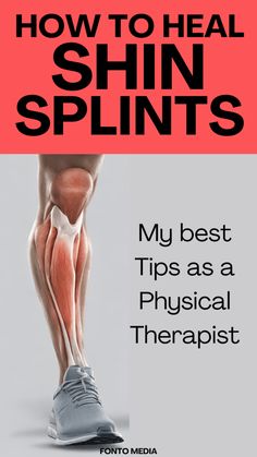 shin splints, tibia fracture, stress fracture, exercice, physical therapy Chin Splints Remedy, Knee Strengthening Exercises