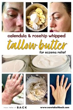 eczema relief tallow balm butter calendula rosehip whipped coconut oil essential oil sweet orange DIY homemade skin care all-purpose diaper rash cream smooth pastured organic healing soothing pain relief home remedy dermatitis sunburn poison ivy Tallow Lotion Recipe, Tallow Lotion, Tallow Recipe, Whipped Tallow, Egg Nutrition, Tallow Balm