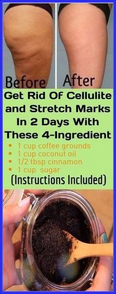 Coffee Coconut, Spa Days, Trening Fitness, Stretch Mark, Beauty Remedies, Teeth Care, Health Knowledge, Homemade Remedies, Body Wraps