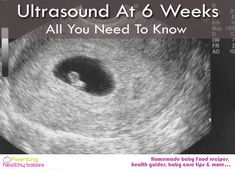 an image of a black and white photo with the words ultrasound at 6 weeks all you need to know