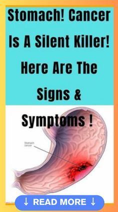 Stomach cancer is the silent killer, here are the signs and symptoms!#StomachCancerAwareness #SilentKiller #CancerSymptoms #StomachHealth #EarlyDetection #CancerPrevention #KnowTheSigns #CancerAwareness #FightCancer #StomachCancerSurvivor #CancerSupport #CancerEducation #CancerAwarenessMonth #CancerWarrior What Is Health, Silent Killer, Healthy Facts, Womens Health Care, Natural Sleep Remedies, Preventative Health, Healthy Liver