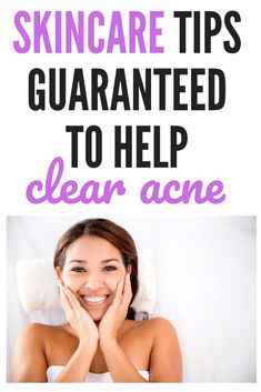 Acne Remedy, Skin Care Hacks, Natural Oils For Skin, Natural Acne Remedies, Severe Acne, Acne Control