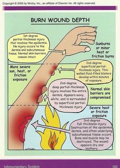 Burn Wound, Nursing Mnemonics, Nursing School Studying, Nursing School Tips, Medical School Studying, Nursing School Notes, Medical Anatomy