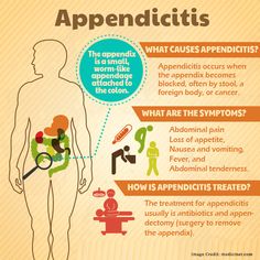 Appendix Surgery, Gastrointestinal Nursing, What Is Nursing, Surgical Nursing, Medical Surgical Nursing, Professional Nurse, Nursing Profession, Nursing Tips, Medical Studies