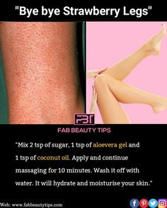 How To Lighten Dark Private Parts Naturally At Home Dark Inner Thighs, Multani Mitti, Strawberry Legs