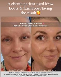 Rodan Fields Lash Boost, Rodan And Fields Consultant, Lash Boost, Rodan And Fields, Lashes, Make Up