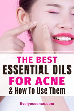 Here are the best essential oils for acne. They are the most effective for treating scars, pimples and breakouts, reducing acne redness. They help reduce inflammation and are antimicrobial. Learn how to use essential oils for acne and get clear skin. #essentialoils #acne Deep Pimple