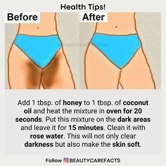 How To Remove Inner Thigh Darkness, Face Darkness Removal, Private Part Lightening, Dark Inner Thighs, Beginner Skin Care Routine, Skin Care Basics, Natural Skin Care Remedies, Clear Healthy Skin, Natural Face Skin Care