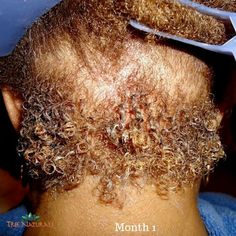 Remedies For Bee Stings, Rice Flower, Gabor Wigs, Aloe Vera Powder, Rosemary Tea, Growing Hair, How To Grow Natural Hair, Christian Images, Safflower Oil