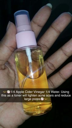 Apple Cider Vinegar Face Toner, Apple Cider Vinegar Face, Skin Lightening Diy, Losing 40 Pounds, Clear Skin Tips, Healthy Skin Tips, Facial Skin Care Routine, Skin Remedies