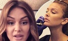 Lala Kent reveals how she used Botox to transform her face Lip Tattoo Lipstick, Thinner Face, Lala Kent, Small Forehead, Botox Before And After, Botox Fillers, Reconstructive Surgery